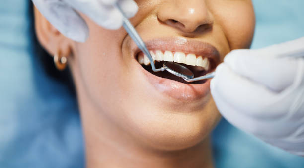 Best Emergency Broken Tooth Repair in Burien, WA