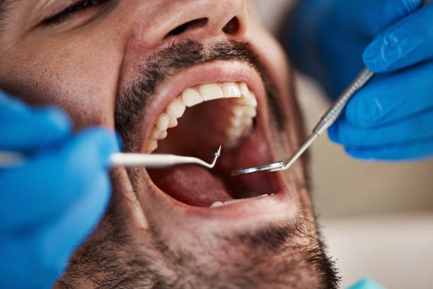 Best Pediatric Emergency Dentist in Burien, WA
